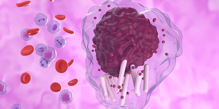 Chemo-Free Therapy in Pediatric Acute Promyelocytic Leukemia
