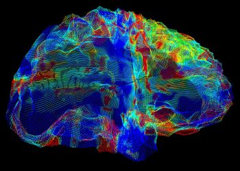 Next generation Alzheimer’s drug reduces risk of serious brain bleeds