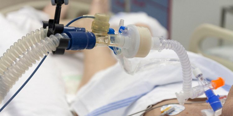 Mucus Thinners Yield Troubling Results for Ventilated ICU Patients