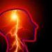 Q&A: A physician discusses reducing stroke risk