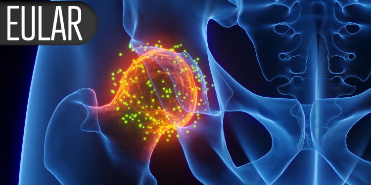 How Much Prednisone Is Too Much in Treating Rheum Effects From Cancer Therapies?