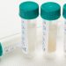 Are Saliva and Urine Rheumatology’s Next Biomarker Frontier?
