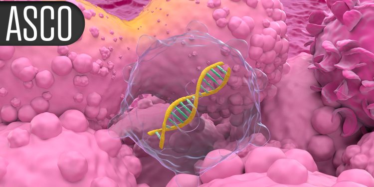 Practice-Changing Trial in Prostate Cancer Shows Benefits of Perioperative Therapy