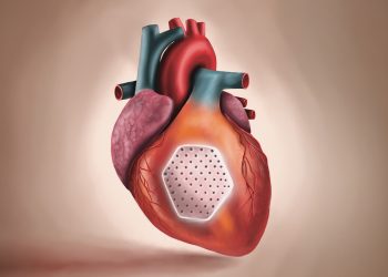 Dawn of Heart Muscle Patches to Address Lost Myocardium in Heart Failure