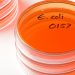 USDA posts warning about beef kofta linked to E. coli outbreak