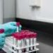 Blood biomarkers could detect earliest signs of Alzheimer’s disease—and slow its progression