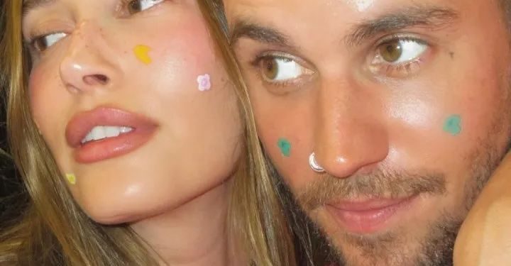 Hailey Bieber Is Healing Her Blisters With…Pimple Patches?
