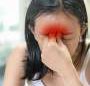 A third of patients with chronic rhinosinusitis with nasal polyps exhibit anxiety symptoms