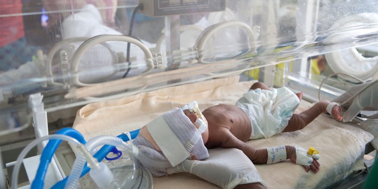 Study Reassures on Probiotic Sepsis Risk in Very Preterm Infants