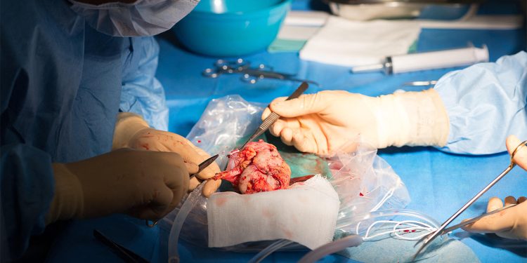 COVID Study Supports Antiviral Use in Kidney Transplant Recipients