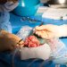 COVID Study Supports Antiviral Use in Kidney Transplant Recipients