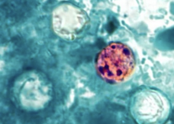 Michigan posts more than 1,000 new Cyclospora cases