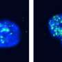Study finds new weak spot linked to DNA repair in aggressive, drug-resistant cancers