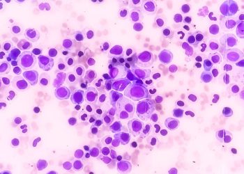 EMA Recommends New Hematology and Supportive Care Drugs