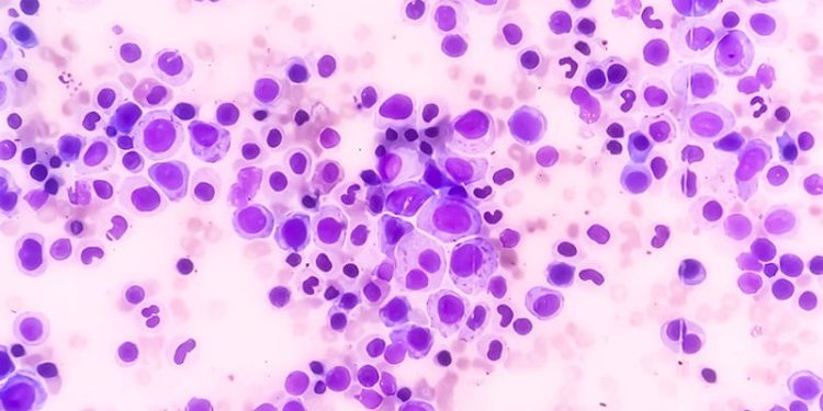 EMA Recommends New Hematology and Supportive Care Drugs
