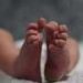 Premature babies who do not catch up well on growth may suffer brain abnormalities