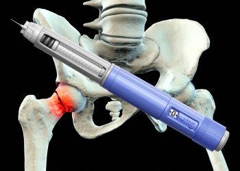 Study Links GLP-1s to Lower Risk of Fragility Fractures in Diabetes Patients