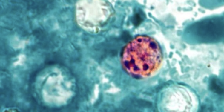 State-by-state count in parasitic outbreak continues to increase