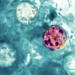 State-by-state count in parasitic outbreak continues to increase