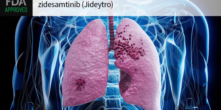 FDA Greenlights Next-Generation ROS1 Inhibitor for Lung Cancer