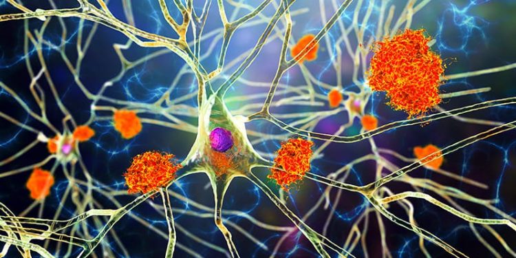 First Evidence That Targeting Tau May Slow Cognitive Decline
