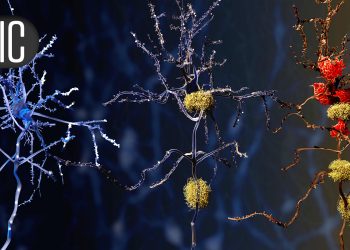 Brain Aging Advances More Quickly for People With Metabolic Syndrome