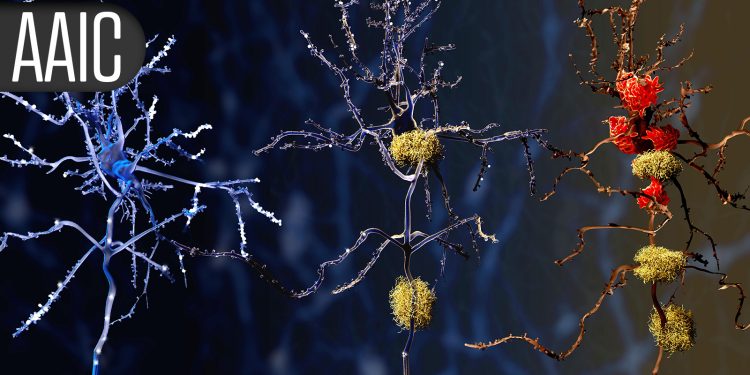 Faster Cognitive Decline Linked to Cumulative Physiologic Stress