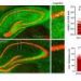Extra SORLA protein shields brain connections from tau tangles in mouse models