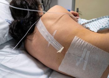 Study Offers Reassurance to Women Considering Epidural During Labor