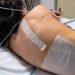 Study Offers Reassurance to Women Considering Epidural During Labor