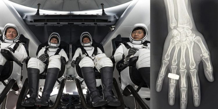 Astronauts Obtain First X-Rays in Space