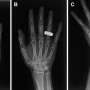 First diagnostic X-rays in space mark new era for astronaut health