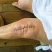 Aspirin Alone Gets the Job Done for Clot Prevention After Joint Surgery