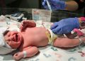 Study Warns of Brain Bleeding for Some Babies Who Don’t Get Vitamin K Shot