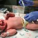 Study Warns of Brain Bleeding for Some Babies Who Don’t Get Vitamin K Shot