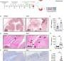 Researchers reveal immune mechanisms that drive development of rare allergic stomach disease