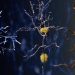 Alzheimer’s Autopsy Study Raises Questions About Amyloid Clearance
