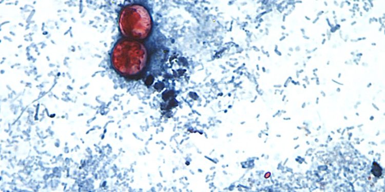 How to Stay Safe and Enjoy Produce This Summer With the Cyclosporiasis Outbreak