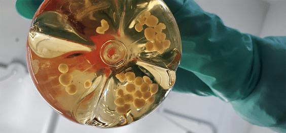 The Remarkable Lives of 5-Year-Old Brain Organoids