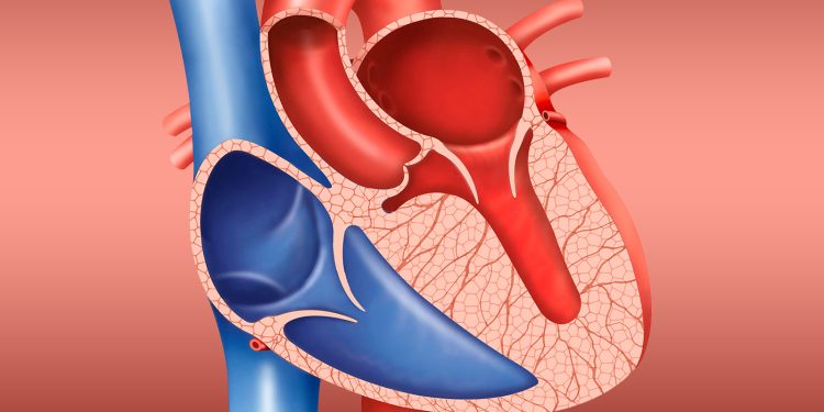 A Better Idea of When Mild HCM Is Likely to Go Downhill Fast