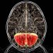 Modified Amino Acid Improves Neurologic Symptoms in Rare Genetic Disorder
