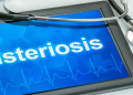 Scientists propose label to help people avoid Listeria infection