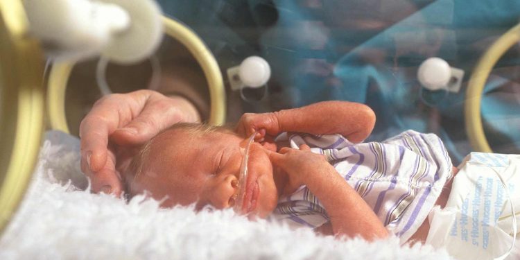 Amnioinfusions Mitigate Lethal Lung Hypoplasia From Fetal Kidney Failure