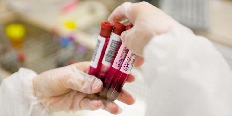 Recommending Blood Tests for CRC Without Guardrails Risks Confusion
