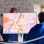 Specialized procedure saves a young woman’s ability to walk