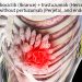 FDA Approves CDK4/6 Inhibitor for HER2-Positive Breast Cancer