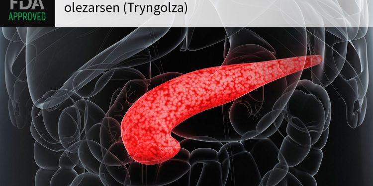 Severe Hypertriglyceridemia Drug Approved to Reduce Triglycerides, Pancreatitis Risk