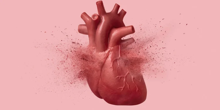 “Broken heart syndrome” can look just like a heart attack. This test can tell them apart