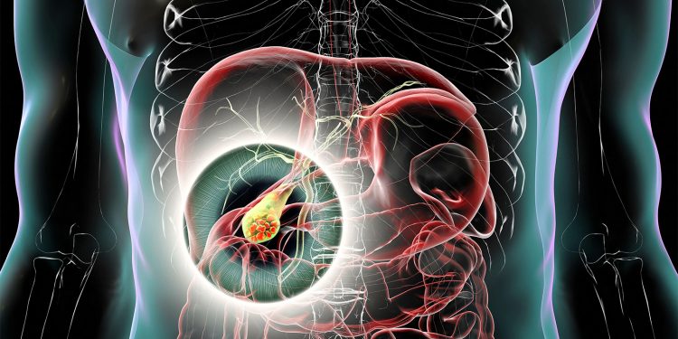 GLP-1 Drugs Tied to Gallbladder and Biliary Risks in Youth