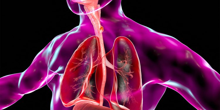 ‘Practice-Changing’ Data Expand Zanidatamab’s Approval to Gastroesophageal Cancer